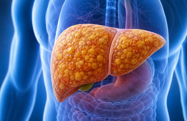 Fatty Liver Screening Package Advanced Fibroscan Test