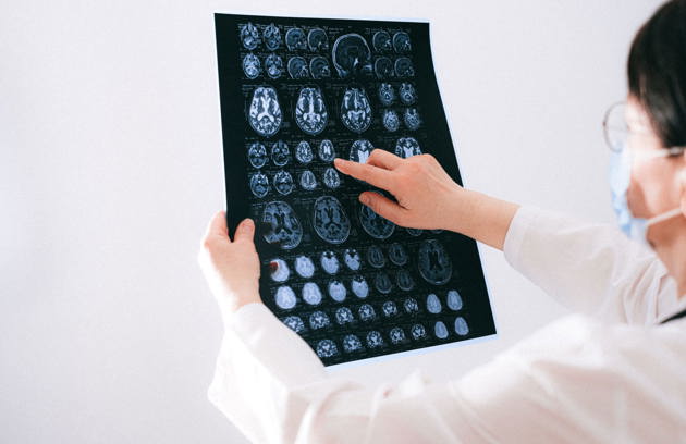 Doctor in a white coat pointing at a sheet of brain MRI scans while reviewing results at a memory & brain health clinic