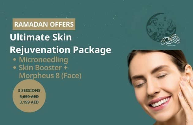 For Assets Ramadan Offers Landing Page (630 X 408)